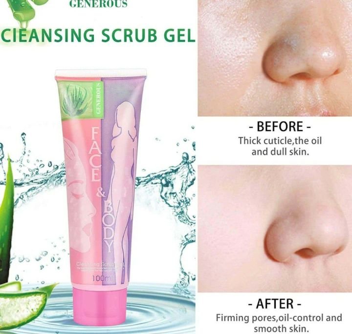 aloevera Gel